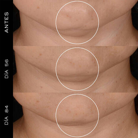 RENERGIE CREAM SPF 20