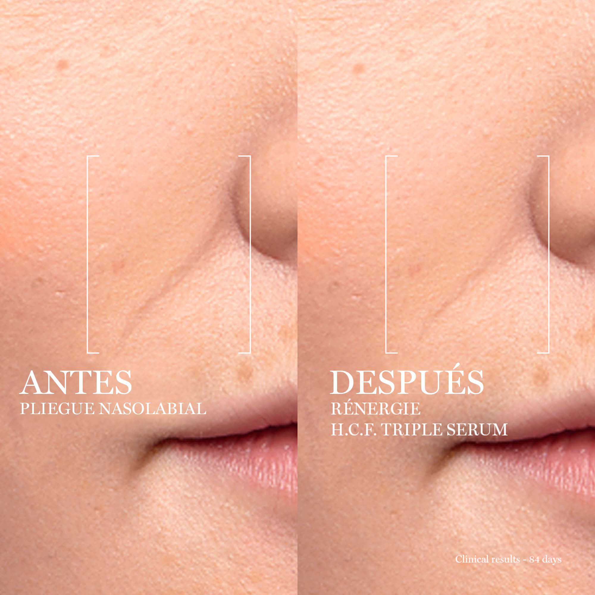 RENERGIE H.C.F. TRIPLE SERUM